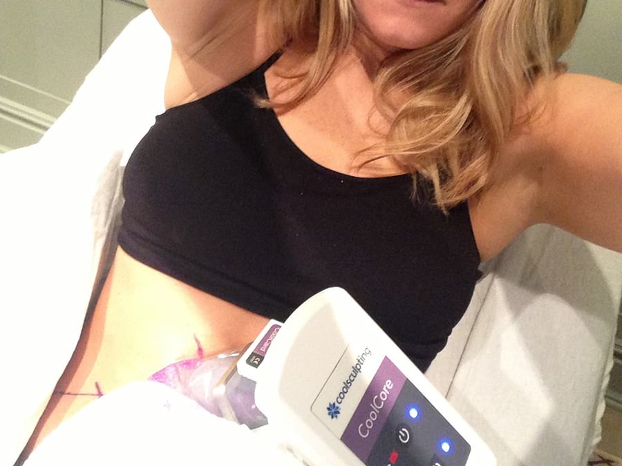 2015 Is the Year of CoolSculpting: Dr. Capizzi’s Forecast for 2015
