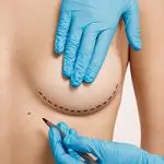Woman being prepped for plastic surgery.