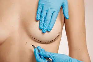 Woman being prepped for plastic surgery.