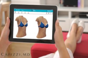 Image of women looking for the prefect breast implant using Crisalix 3D software