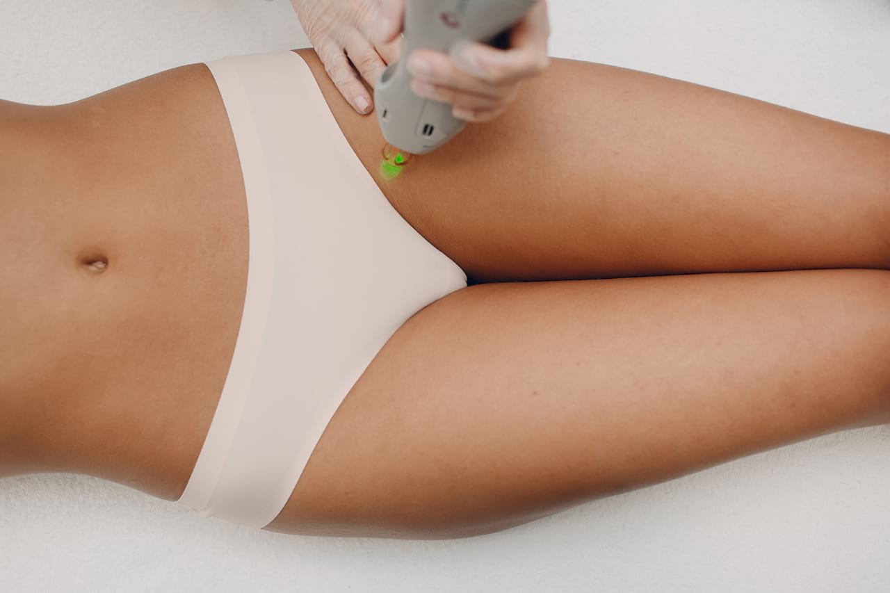 Image of a woman receiving laser hair removal on her inner thigh