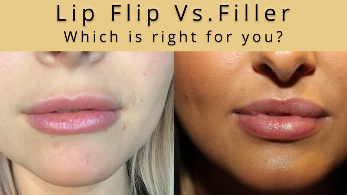 lip implant sizes