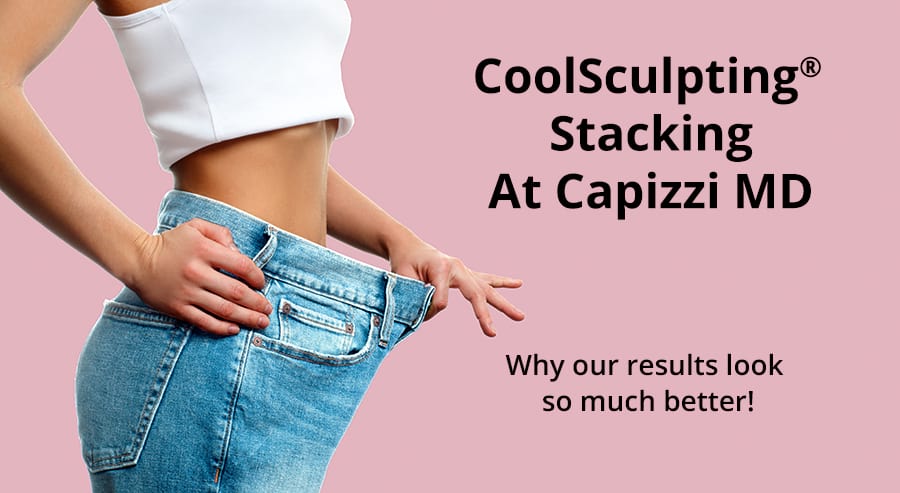 Woman holding her pants out showing how much fat she lost after undergoing CoolSculpting Stacking at Capizzi MD.