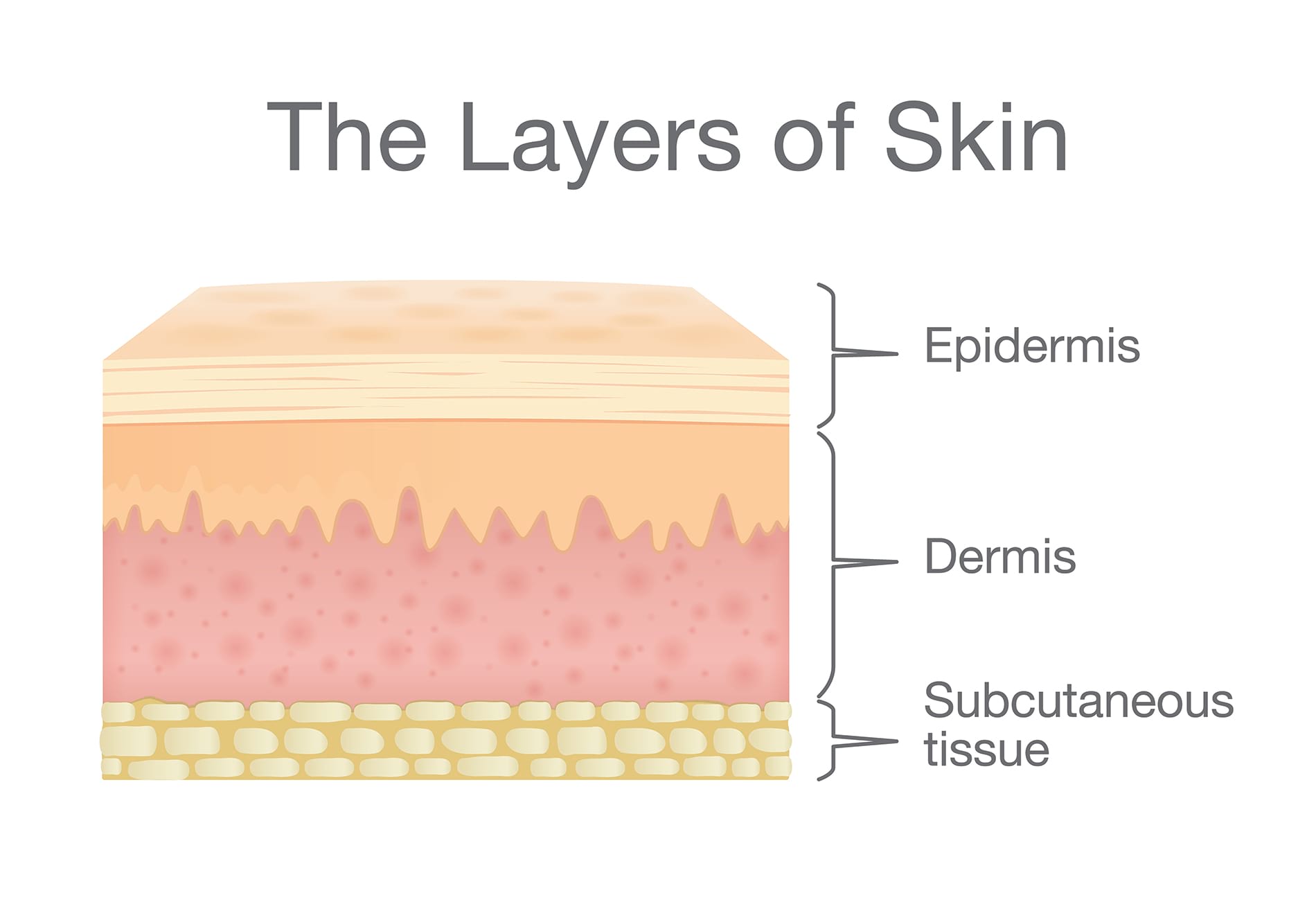 Graphic showing the three main layers of skin.