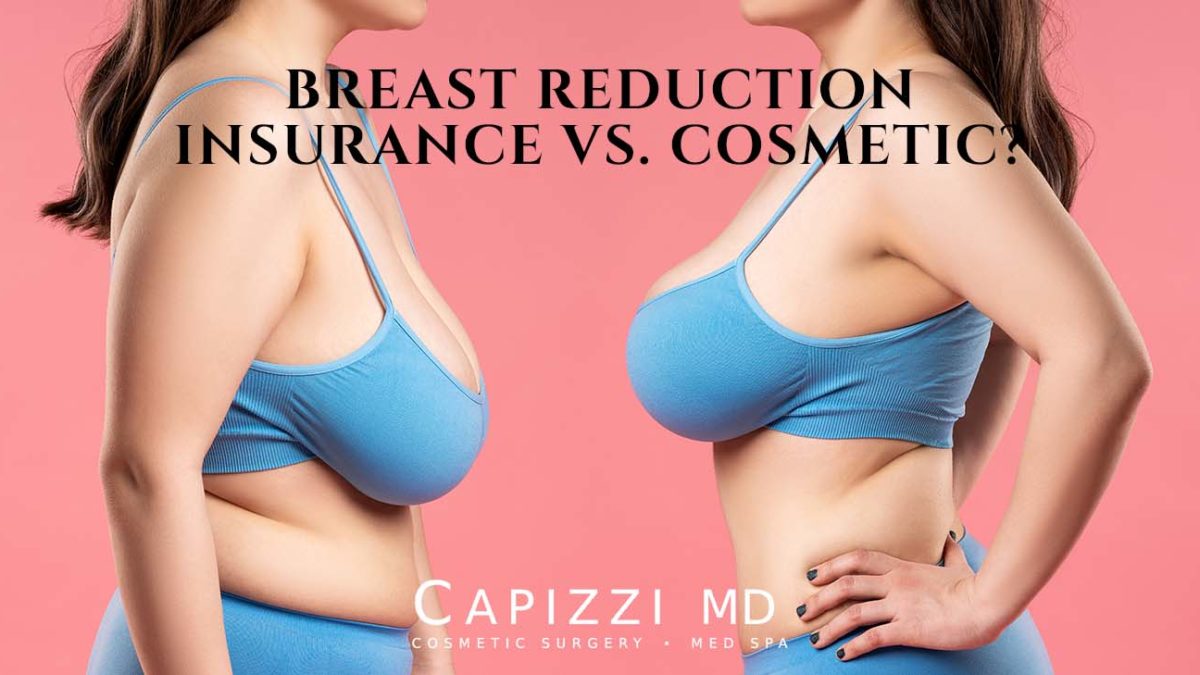 Medically Necessary Breast Reduction: NYSHIP Requirements for Skin