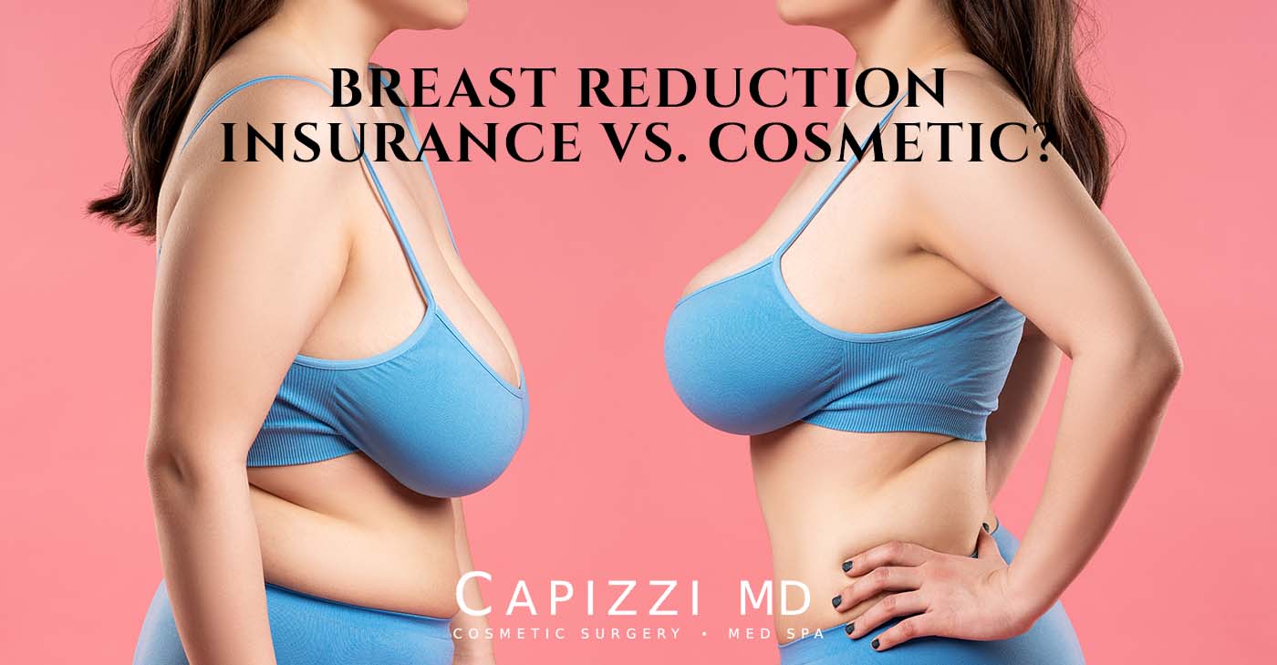 Breast Reduction – Insurance vs. Cosmetic Surgery