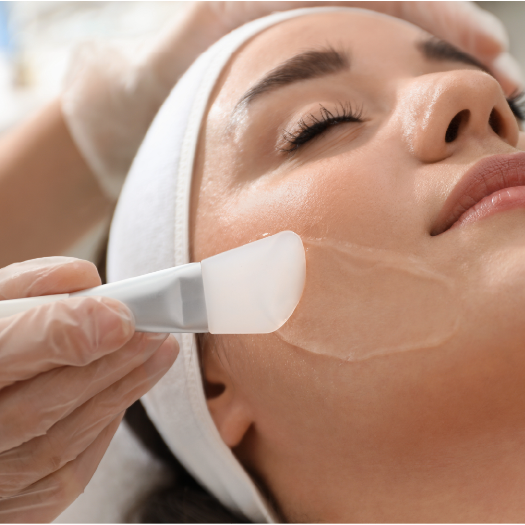 Chemical peels exfoliate and resurface skin to remove pigmentation and congestion