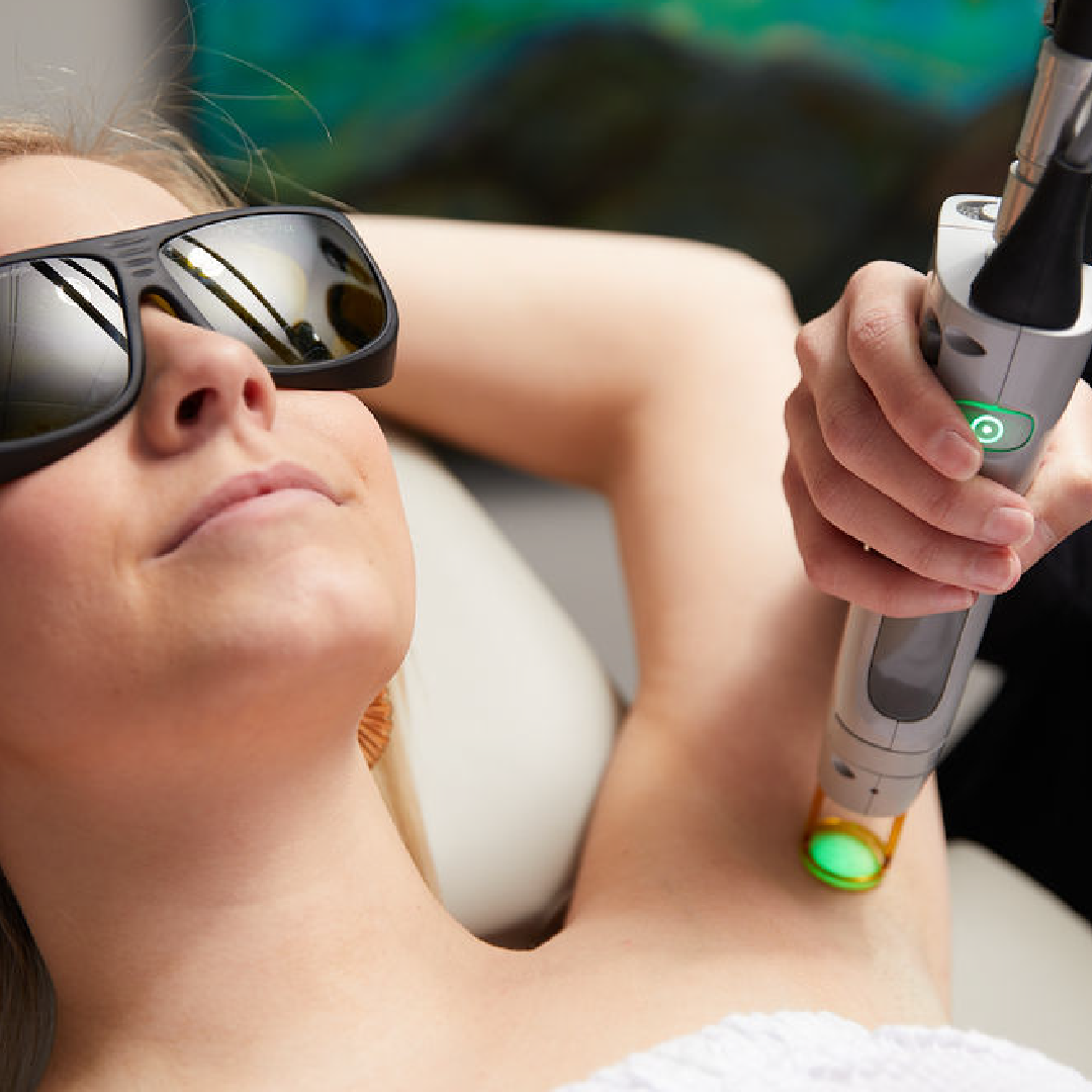 Laser hair removal treatment reduces unwanted hair