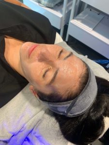 Woman with numbing cream on her face waiting for the affects before microneedling.