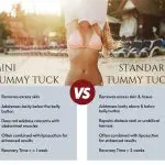 Mini Tummy Tuck comparison with Standard Tummy Tuck.