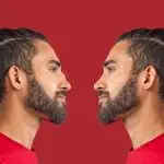 Before and After Comparison of a Man with an Ultrasonic Rhinoplasty