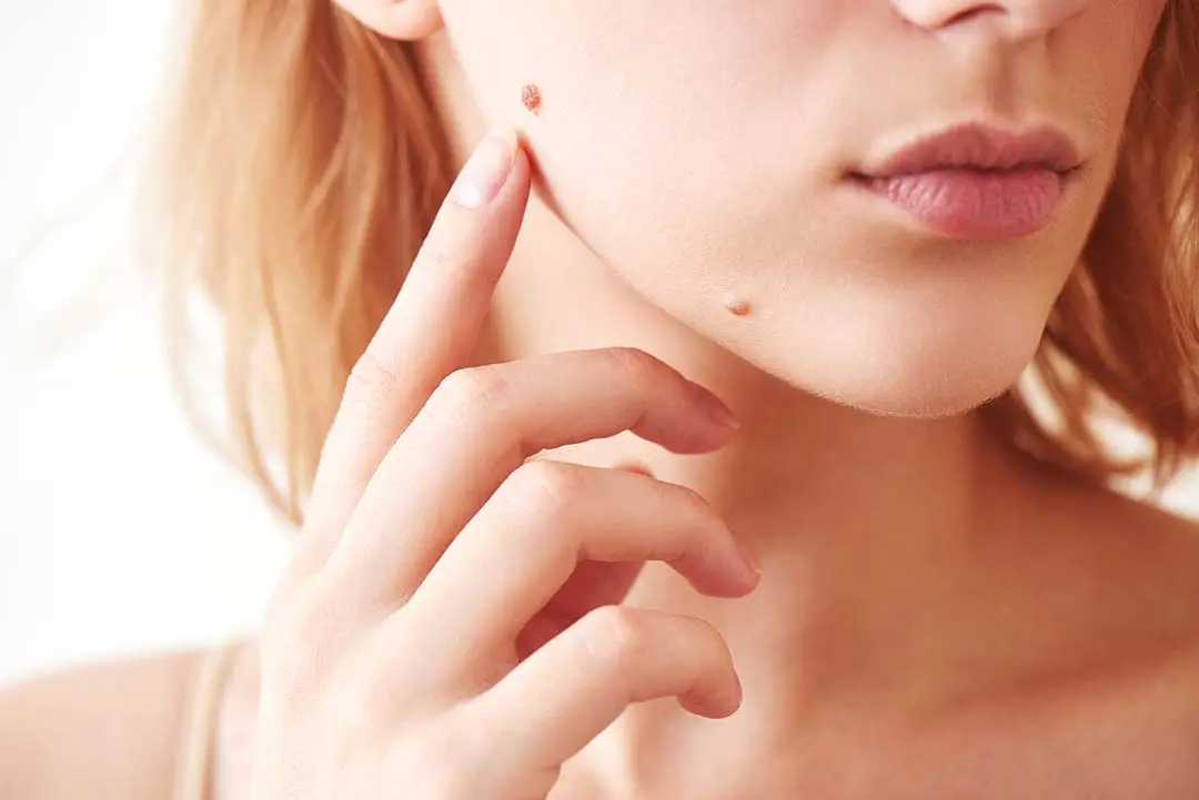 Dermatologist vs. Plastic Surgeon. Which is Better?