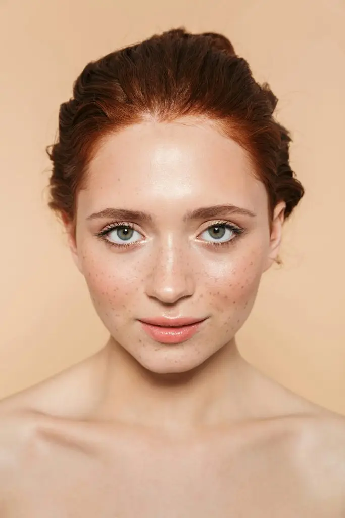 Chemical Peels