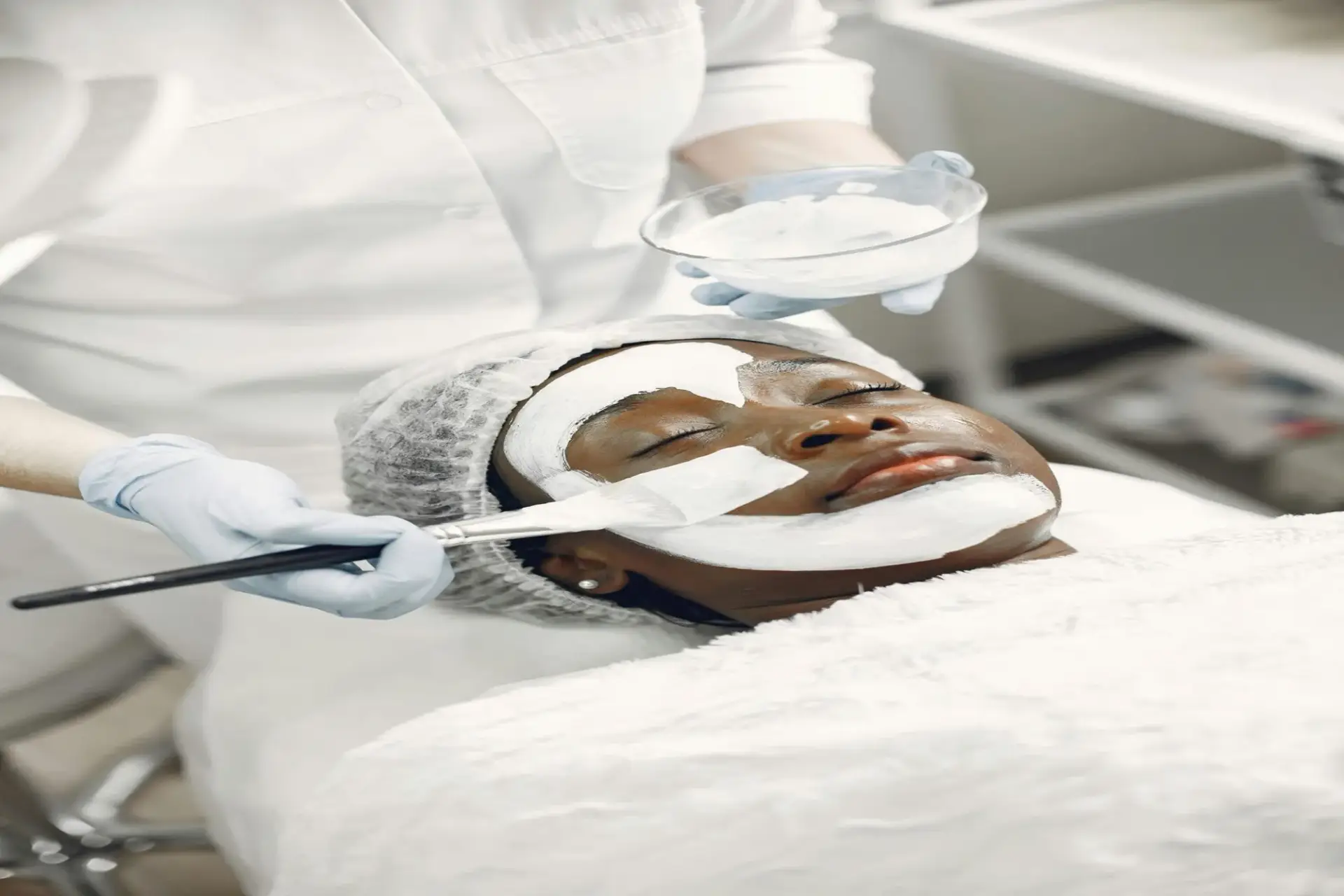 Chemical Peels