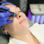 Hydrafacial