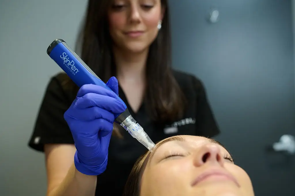 Microneedling Treatment