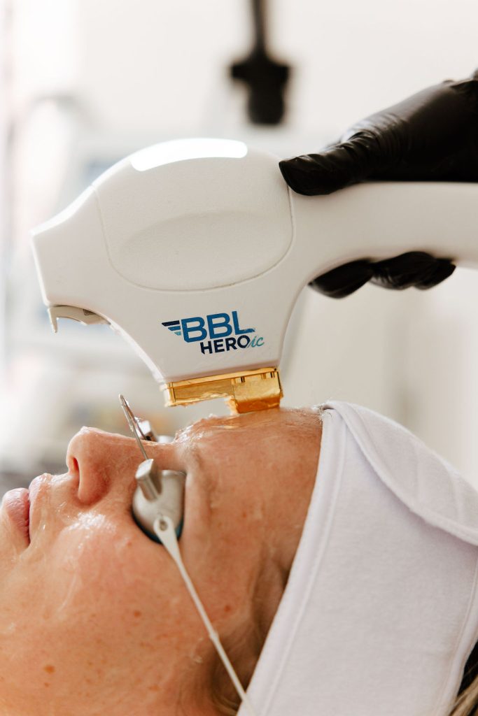 Moxi Laser