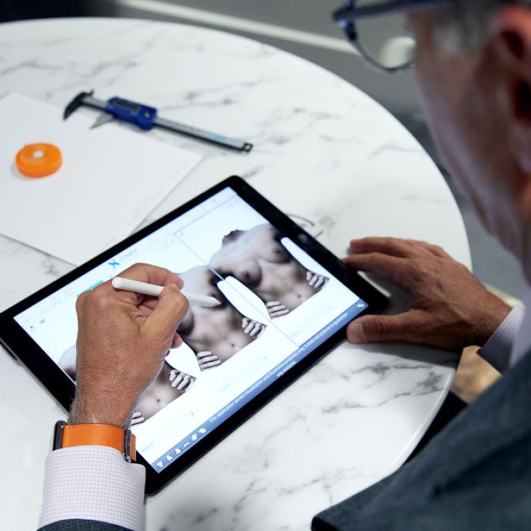 Use of Crisalix 3D to help patient envision breast augmentation results