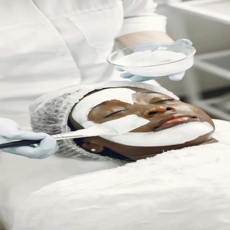 Chemical Peels